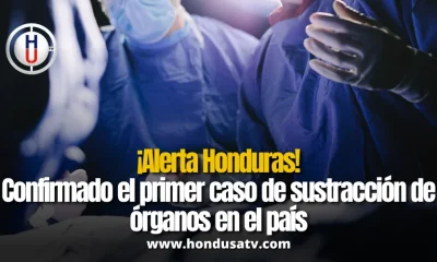 Honduras confirma el primer caso de sustracción de órganos: una mujer descubre que le extrajeron un riñón sin su consentimiento